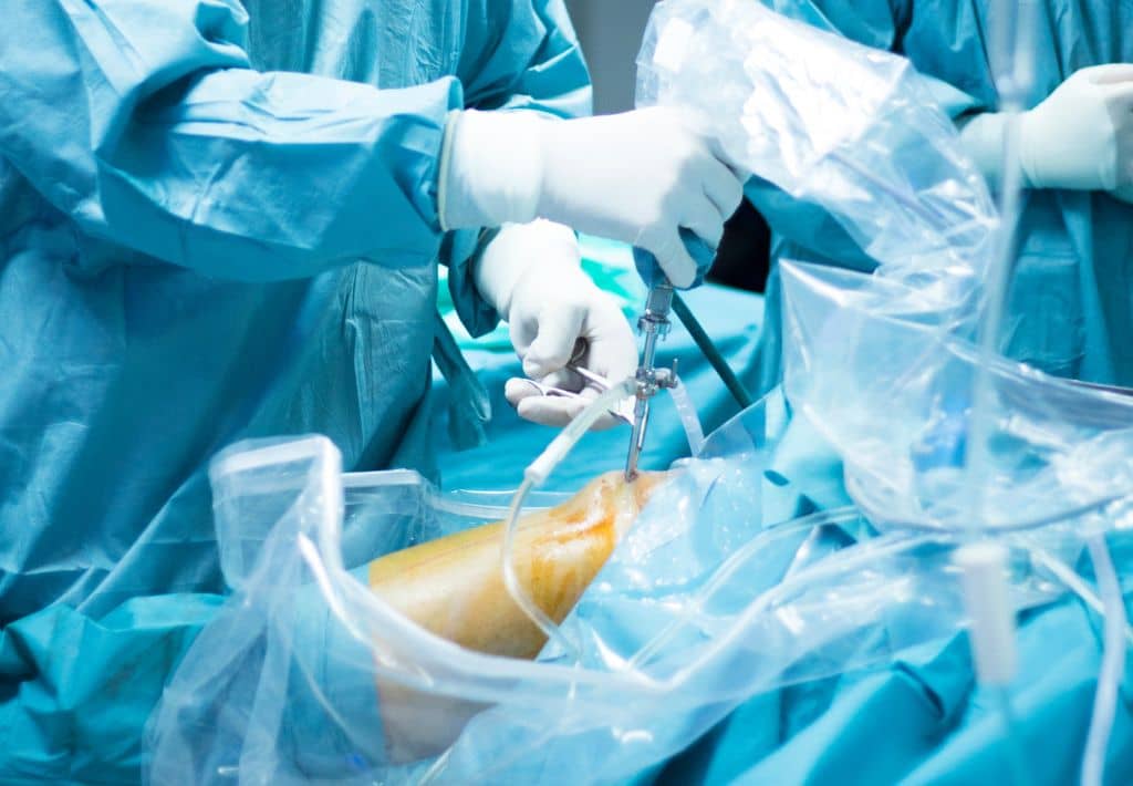 6 Major Advances in Arthroscopic Surgery That Are Changing Joint Care